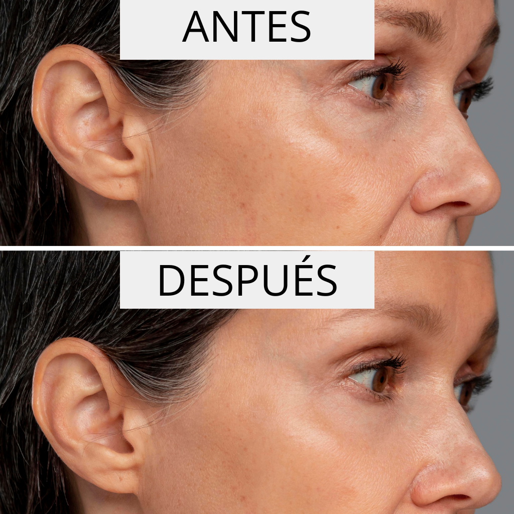 PERPETUAL ΑΝΤΙΡΥΤΙΔΙΚΟΣ ΟΡΟΣ