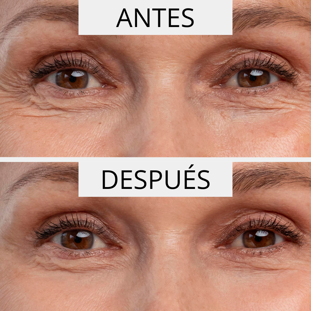 PERPETUAL ΑΝΤΙΡΥΤΙΔΙΚΟΣ ΟΡΟΣ