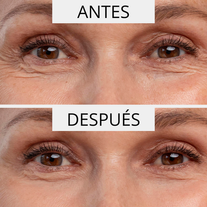 PERPETUAL ΑΝΤΙΡΥΤΙΔΙΚΟΣ ΟΡΟΣ