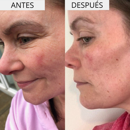 ΕΝΥΔΑΤΙΚΗ + ΕΝΥΔΑΤΙΚΗ ΚΡΕΜΑ