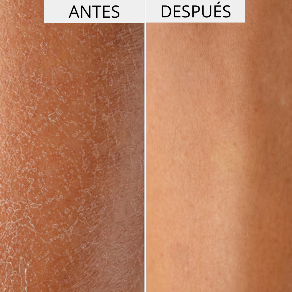 ΕΝΥΔΑΤΙΚΗ + ΕΝΥΔΑΤΙΚΗ ΚΡΕΜΑ