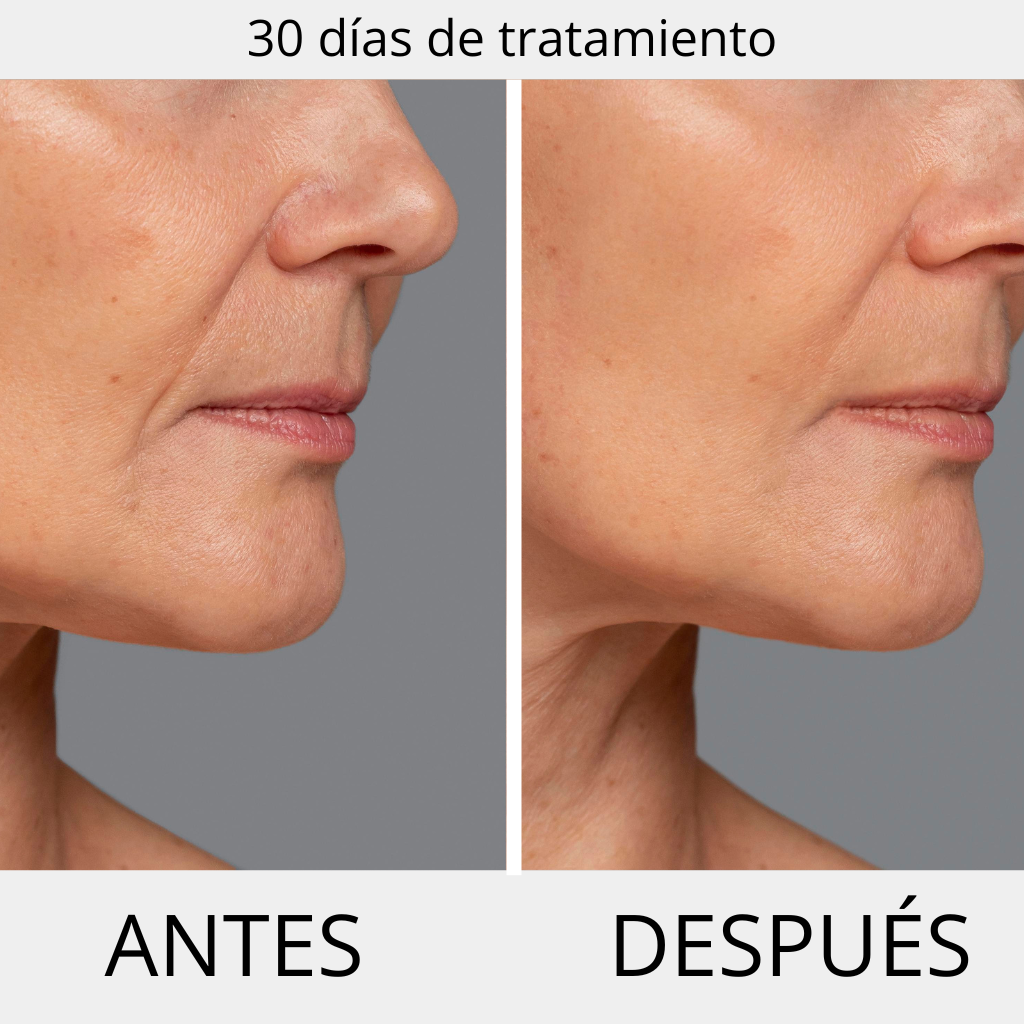 PERPETUAL ΑΝΤΙΡΥΤΙΔΙΚΟΣ ΟΡΟΣ