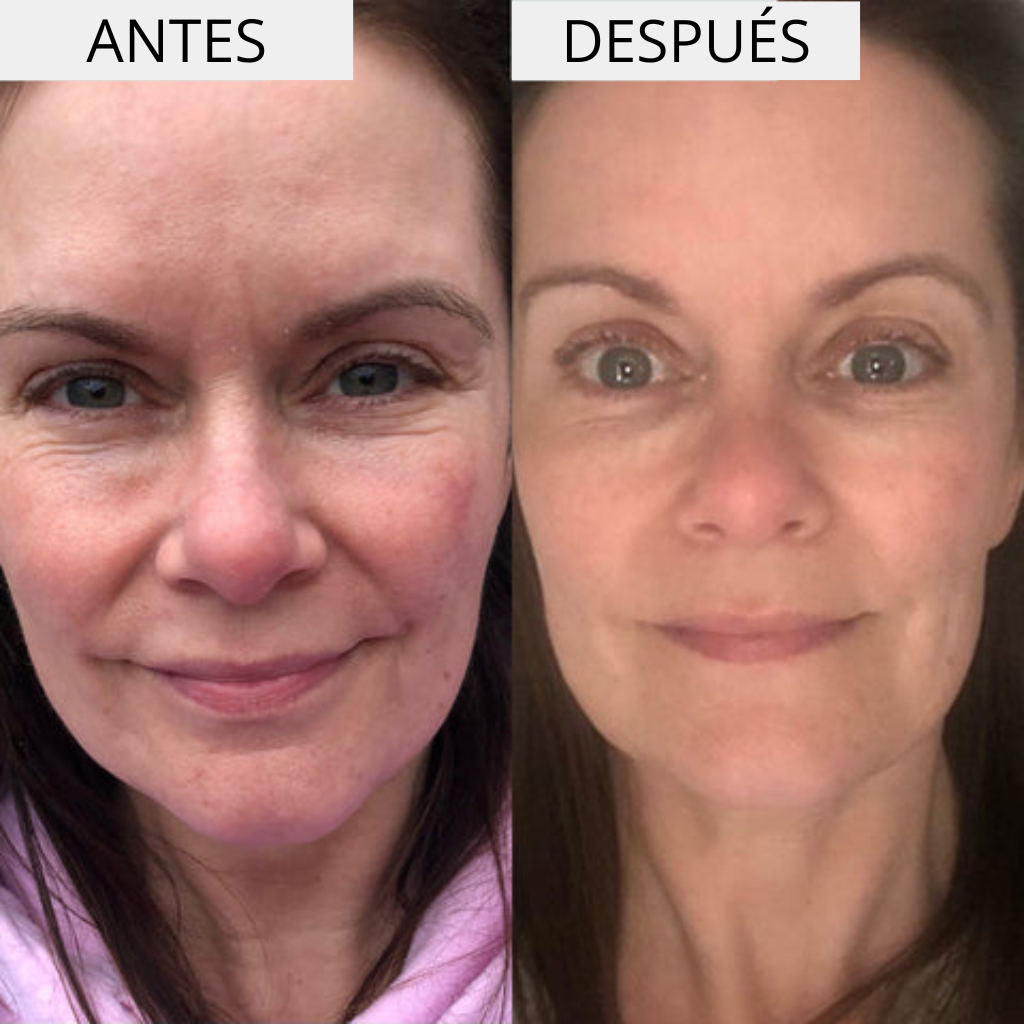 ΕΝΥΔΑΤΙΚΗ + ΕΝΥΔΑΤΙΚΗ ΚΡΕΜΑ