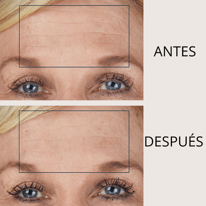 LIFTEA ΑΝΤΙΡΥΤΙΔΙΚΟ ΕΠΙΘΕΜΑ