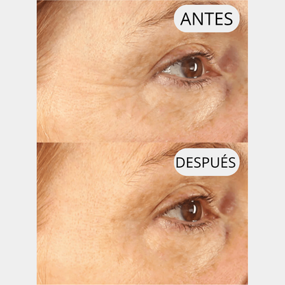 LIFTEA ΑΝΤΙΡΥΤΙΔΙΚΟ ΕΠΙΘΕΜΑ