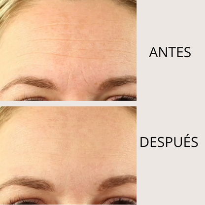 LIFTEA ΑΝΤΙΡΥΤΙΔΙΚΟ ΕΠΙΘΕΜΑ