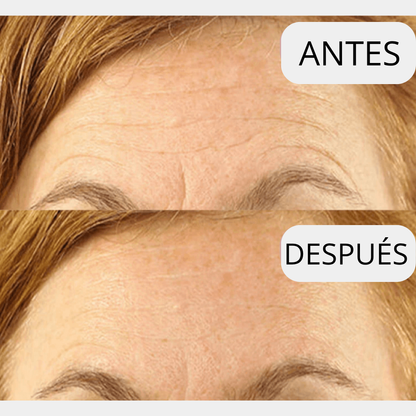 LIFTEA ΑΝΤΙΡΥΤΙΔΙΚΟ ΕΠΙΘΕΜΑ